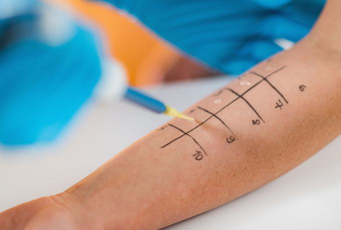 Allergologia - Centro biolab cutrofiano