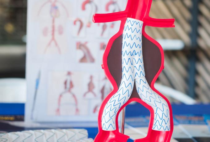 CHIRURGIA VASCOLARE - Centro Biolab Cutrofiano