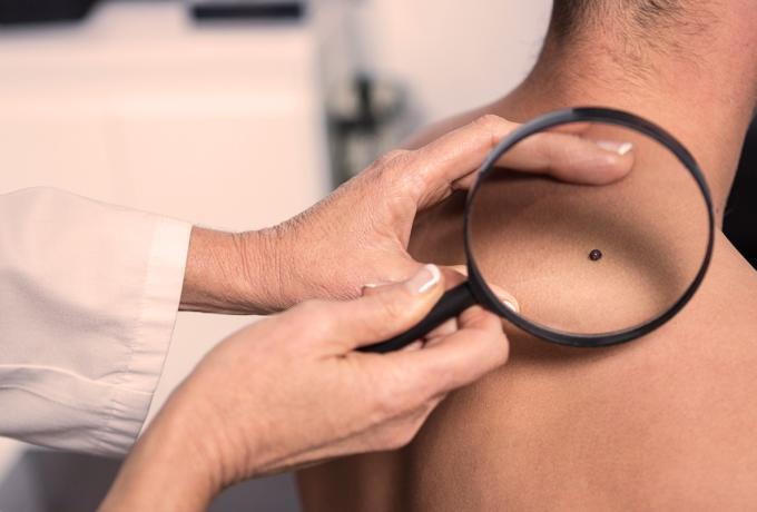 DERMATOLOGIA - Centro Biolab Cutrofiano