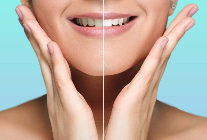 IGIENE DENTALE - Centro Biolab Cutrofiano