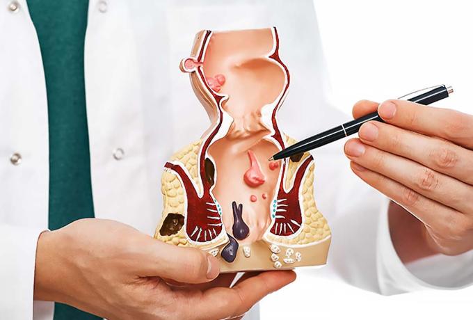 PROCTOLOGIA - Centro Biolab Cutrofiano